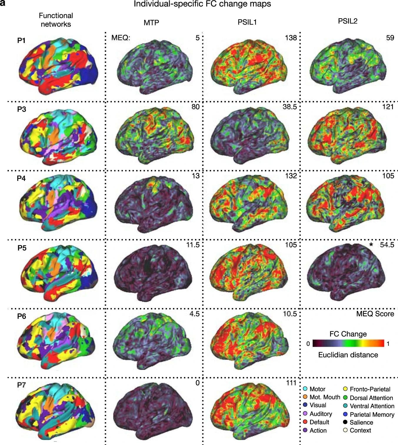 Individual participant methylphenidate (MTP) and psilocybin (PSIL) FC change maps. Left most column shows individuals’ functional networks. Right 3 columns show FC change maps, generated by calculating Euclidean distance from baseline seedmaps for each vertex. For each session the total score on the Mystical Experience Questionnaire (MEQ30: out of a maximum of 150) is given in the upper right corner. *P5 had an episode of emesis 30 minutes after drug ingestion during PSIL2. Study: Psilocybin desynchronizes the human brain
