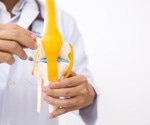 Study finds potential for antidiabetic drugs to modify osteoarthritis risk