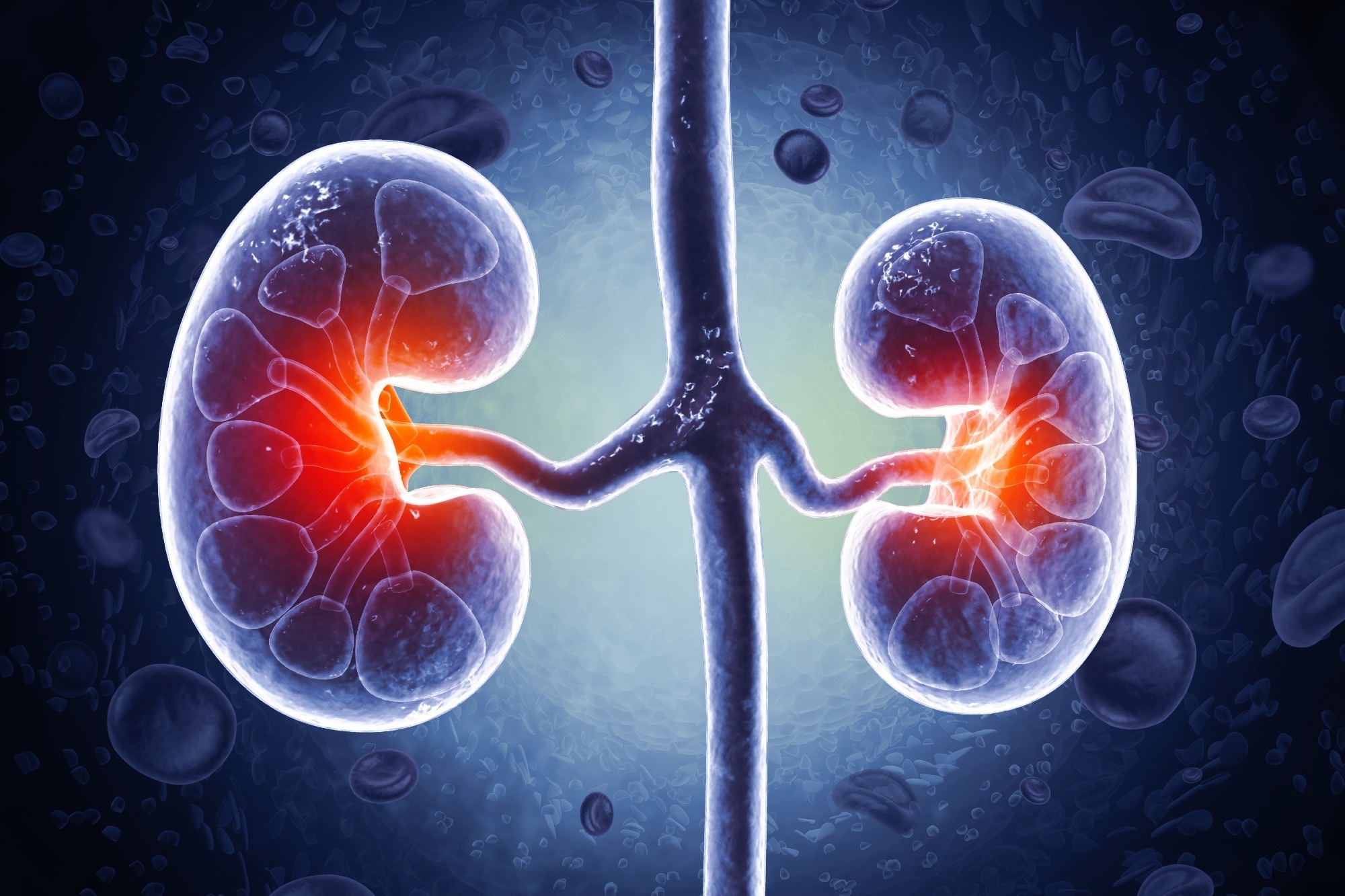 Study: Acute Kidney Injury and Its Association With Dementia and Specific Dementia Types: Findings From a Population-Based Study in Sweden. Image Credit: crystal light / Shutterstock.com