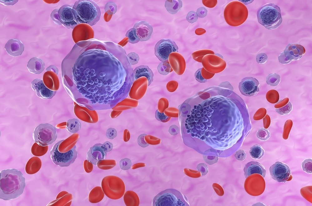 Leukemia cells