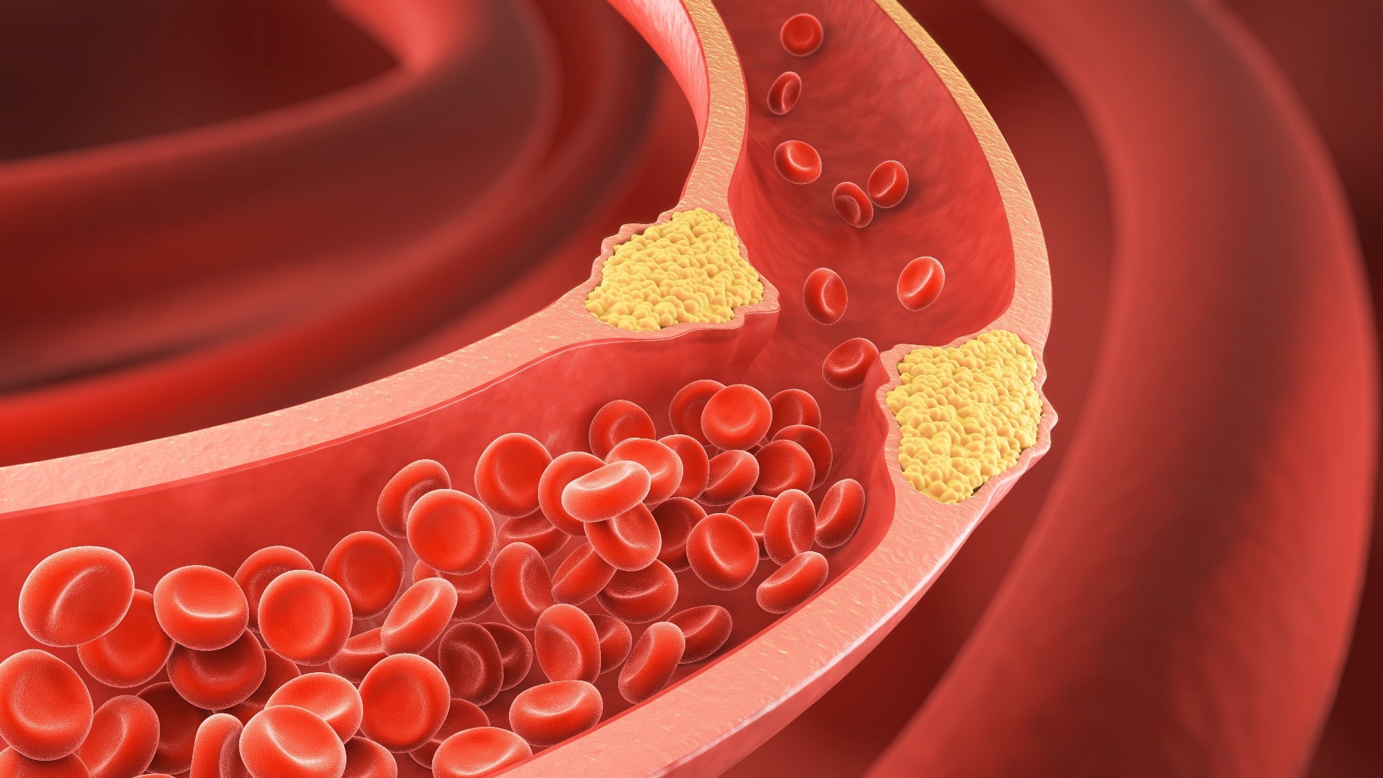 Study: A potent epigenetic editor targeting human PCSK9 for durable reduction of low-density lipoprotein cholesterol levels. Image Credit: Anusorn Nakdee / Shutterstock