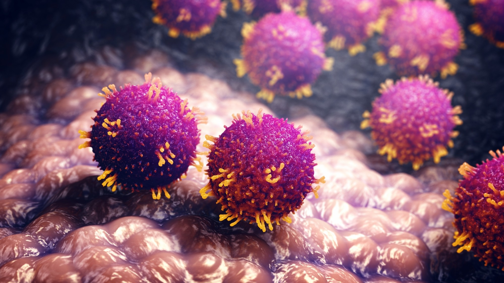 State-of-the-Art Review: What’s Old Is New Again: Measles. Image Credit: nobeastsofierce / Shutterstock