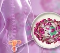 Vaginal microbiome fights back against stubborn BV infections
