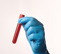 How a simple blood test can forecast future health risks