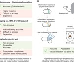 New swallowable sensor pill reveals gut inflammation with a simple color change