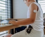 Smarter insulin pump systems help stabilize glucose in young patients, study reveals