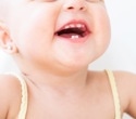 Prenatal stress hormones may shape when a baby’s teeth erupt