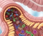 How the gut microbiome links obesity to colorectal cancer