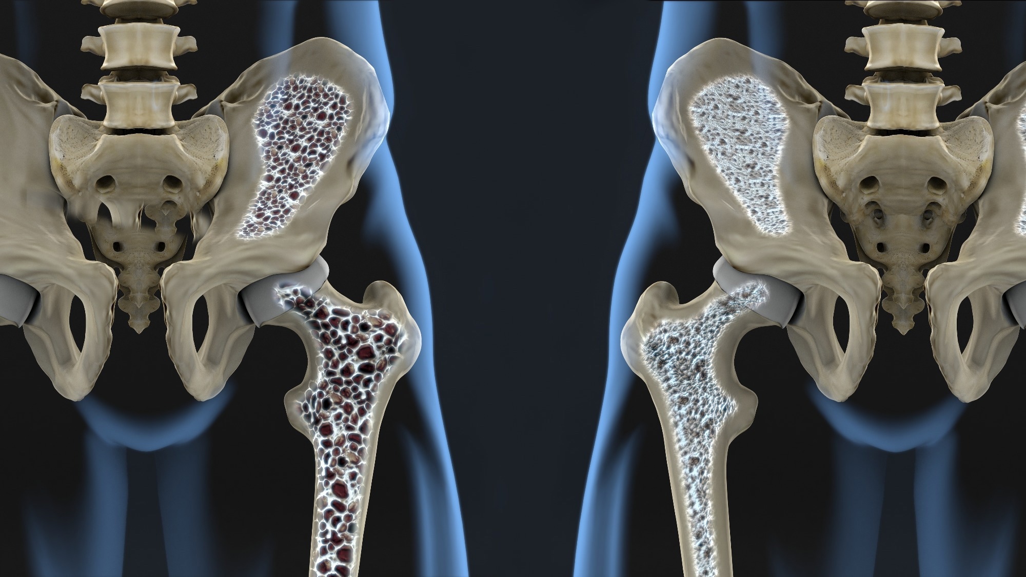 Study: The relationship between serum total alkaline phosphatase and risk of osteoporosis: a cross-sectional study. Image Credit: Javier Regueiro / Shutterstock
