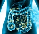 Gut bacteria patterns differ in autism and siblings and link to social symptoms