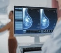 Radiotherapy may be unnecessary for many breast cancer patients after mastectomy