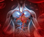 Patients with coronary artery blockages can be treated safely using drug coated stents