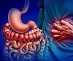 New method brings hope for personalized treatment of inflammatory bowel disease
