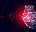 AI enables rapid detection of coronary microvascular dysfunction from standard EKGs