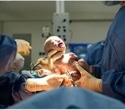New research supports general anesthesia as an option for cesarean births