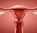 UCSF research maps over 600 conditions linked to endometriosis