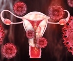 Treatment options for endometriosis