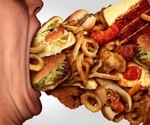Ultra-processed foods linked to precursors of early-onset colorectal cancer
