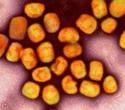Research highlights rising risk of human-to-human mpox transmission
