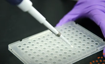 How do I set-up qPCR?